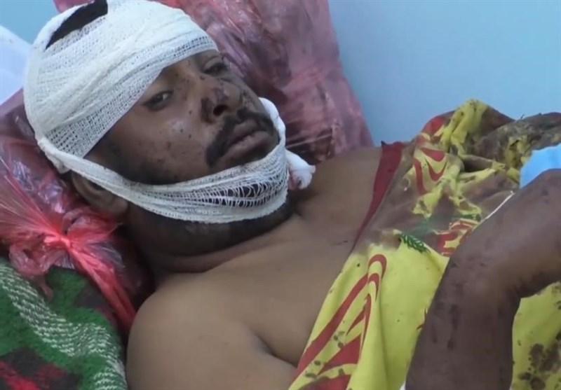 یمن، انصارالله مسئولیت حمله به اردوگاه مأرب را نپذیرفت یمن، انصارالله مسئولیت حمله به اردوگاه مأرب را نپذیرفت