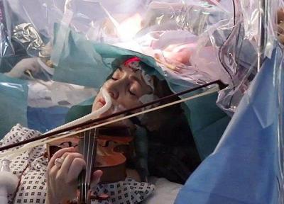 فیلم ، جراحی یک تومور مغزی هنگام ویولون زدن