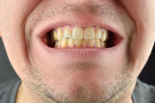 این عادت های غلط دندان های شما را زرد می نماید